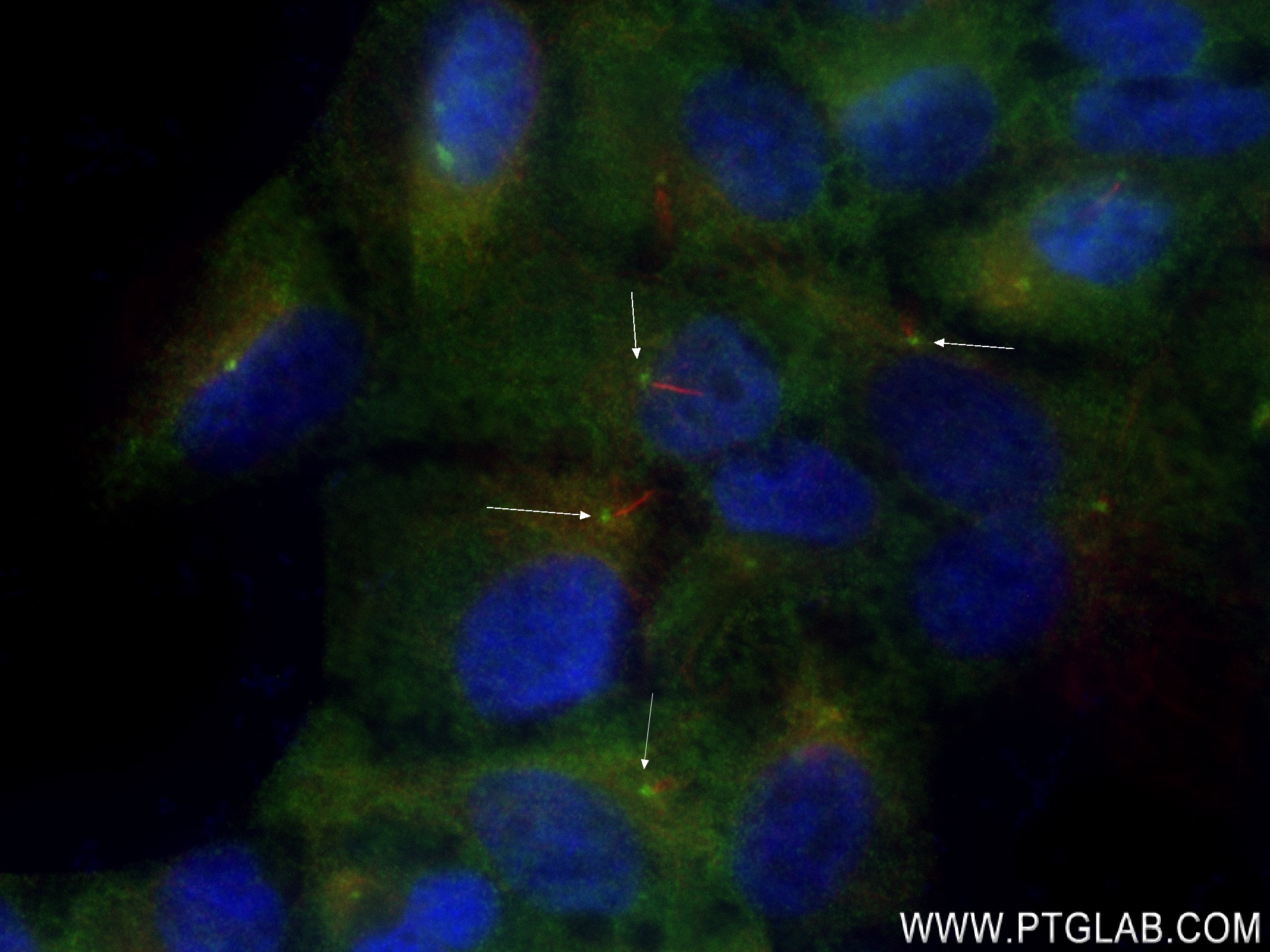 Immunofluorescence (IF) / fluorescent staining of hTERT-RPE1 cells using PLK2 Recombinant antibody (83431-1-RR)