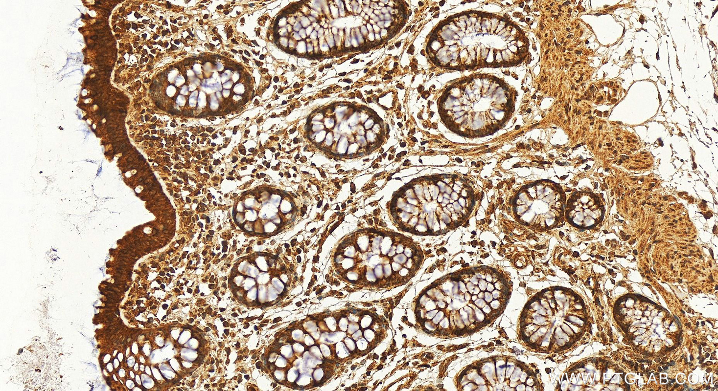 Immunohistochemistry (IHC) staining of human colon tissue using PLK3 Polyclonal antibody (30486-1-AP)