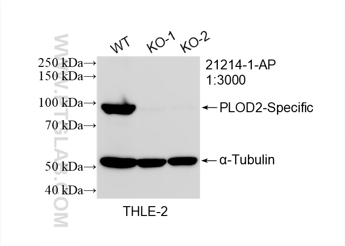 Western Blot (WB) analysis of THLE-2 cells using PLOD2-Specific Polyclonal antibody (21214-1-AP)