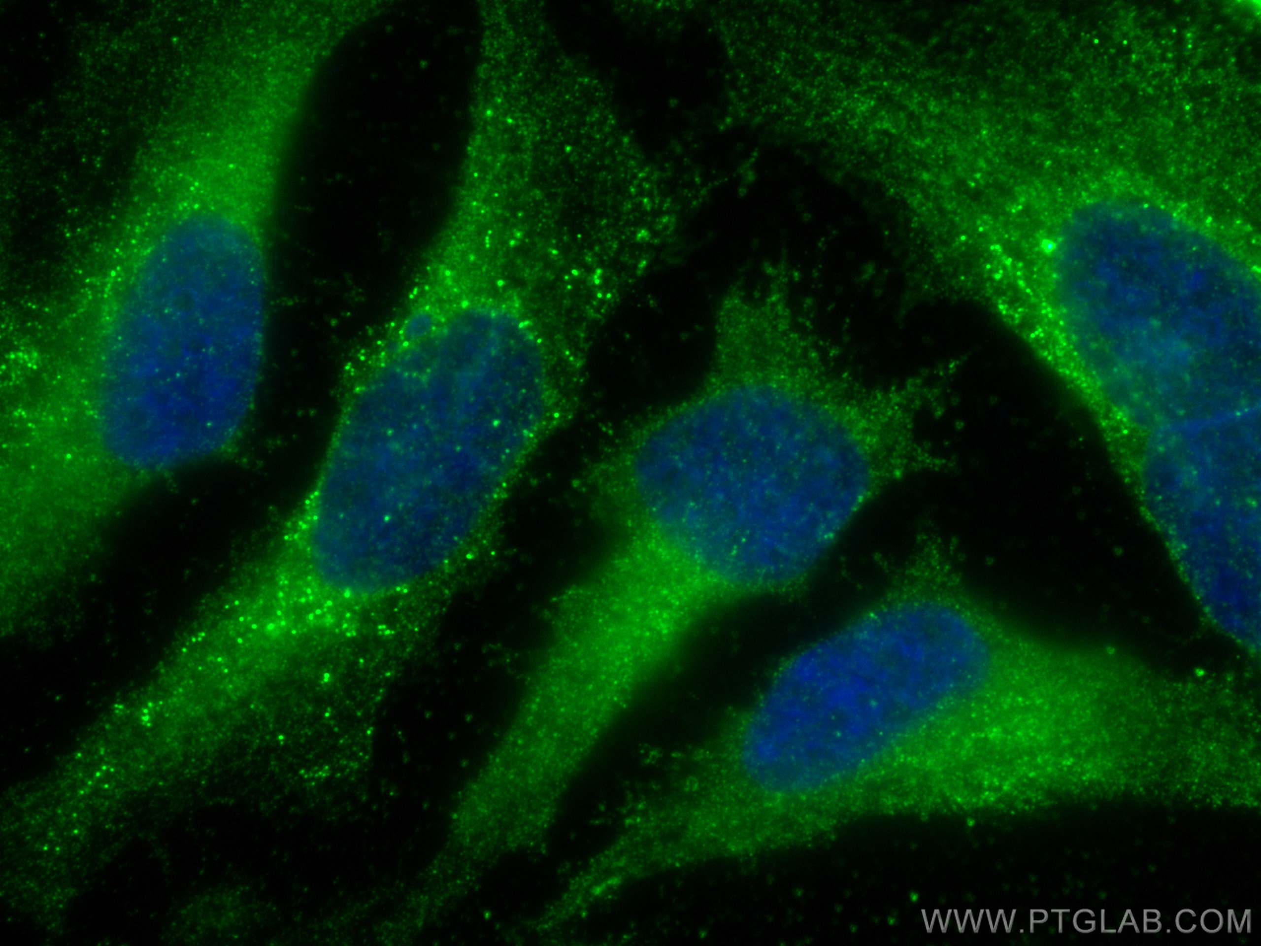 Immunofluorescence (IF) / fluorescent staining of HeLa cells using PLOD3 Monoclonal antibody (60058-1-Ig)