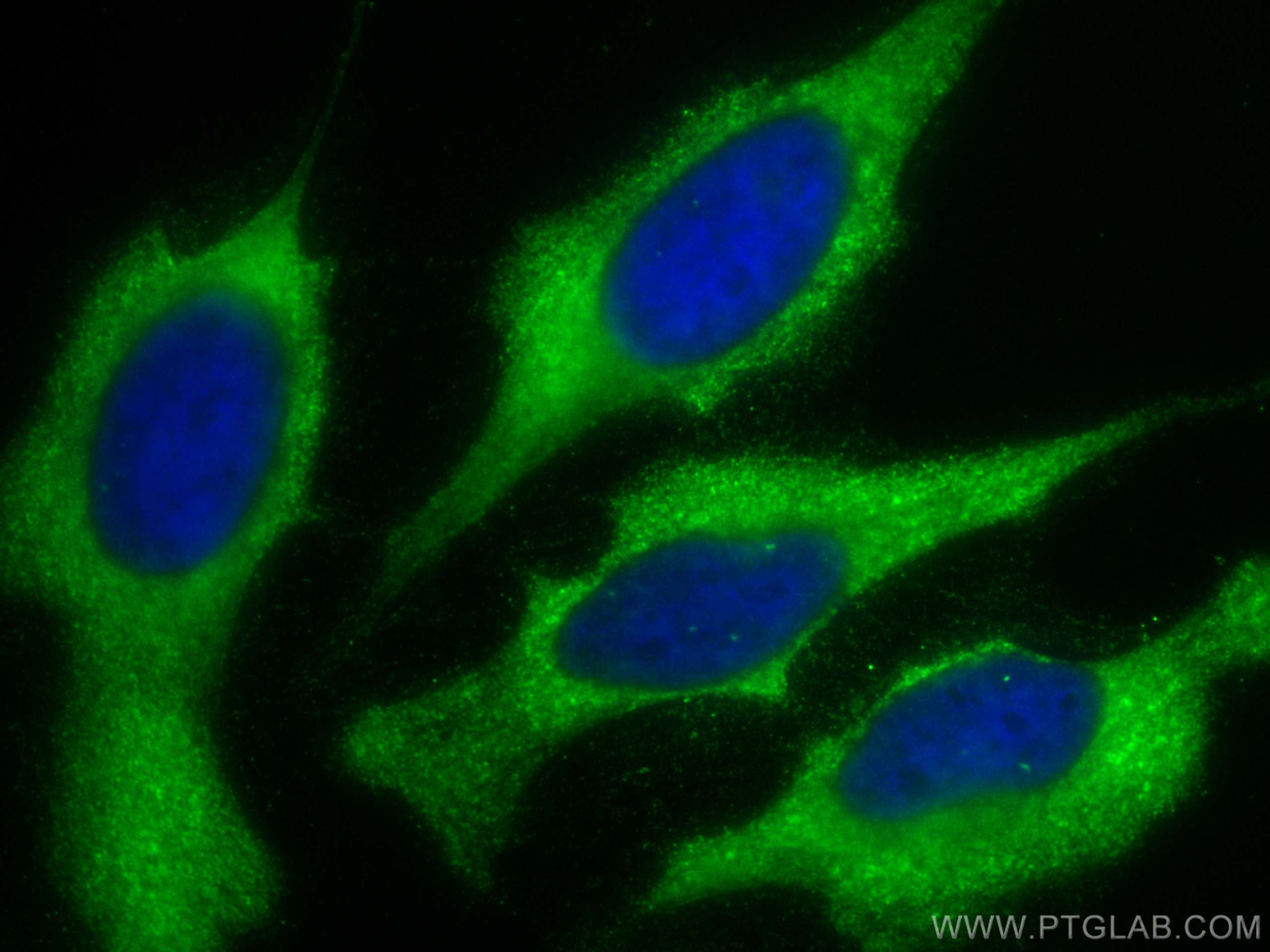 Immunofluorescence (IF) / fluorescent staining of HeLa cells using CoraLite® Plus 488-conjugated PLOD3 Monoclonal ant (CL488-60058)