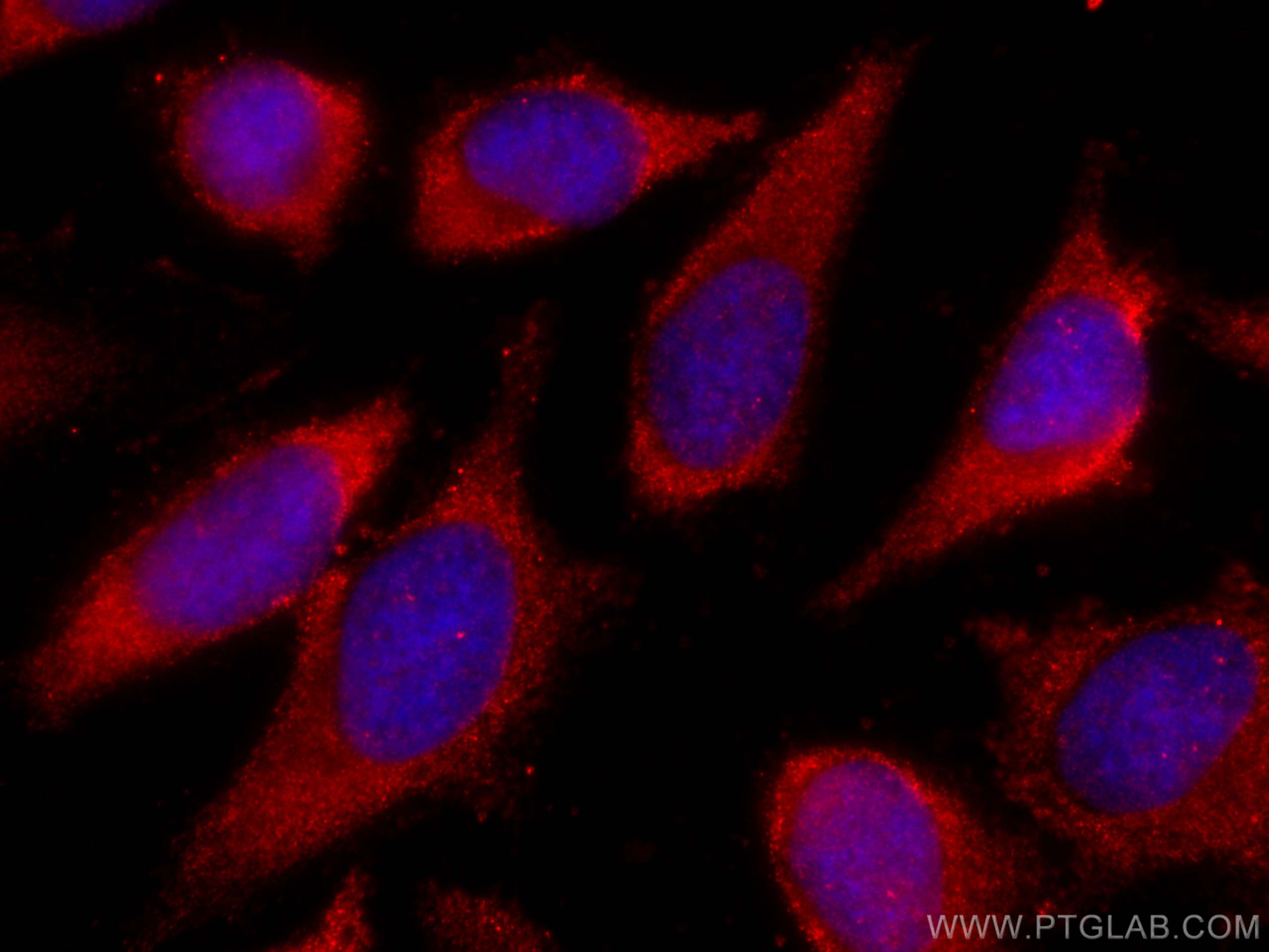 Immunofluorescence (IF) / fluorescent staining of HeLa cells using CoraLite®594-conjugated PLOD3 Monoclonal antibody (CL594-60058)