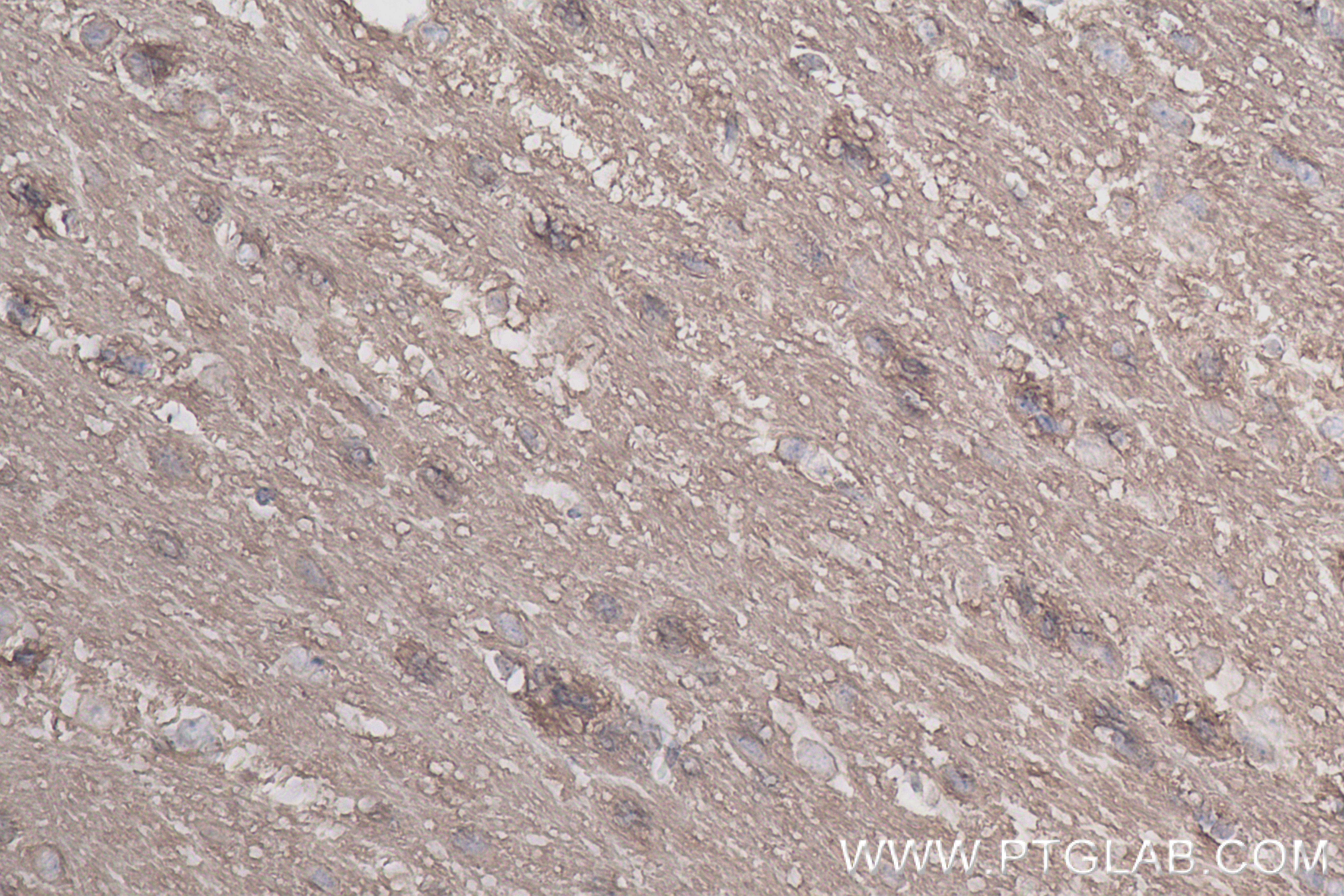 Immunohistochemistry (IHC) staining of mouse brain tissue using PLTP Recombinant antibody (84592-1-RR)