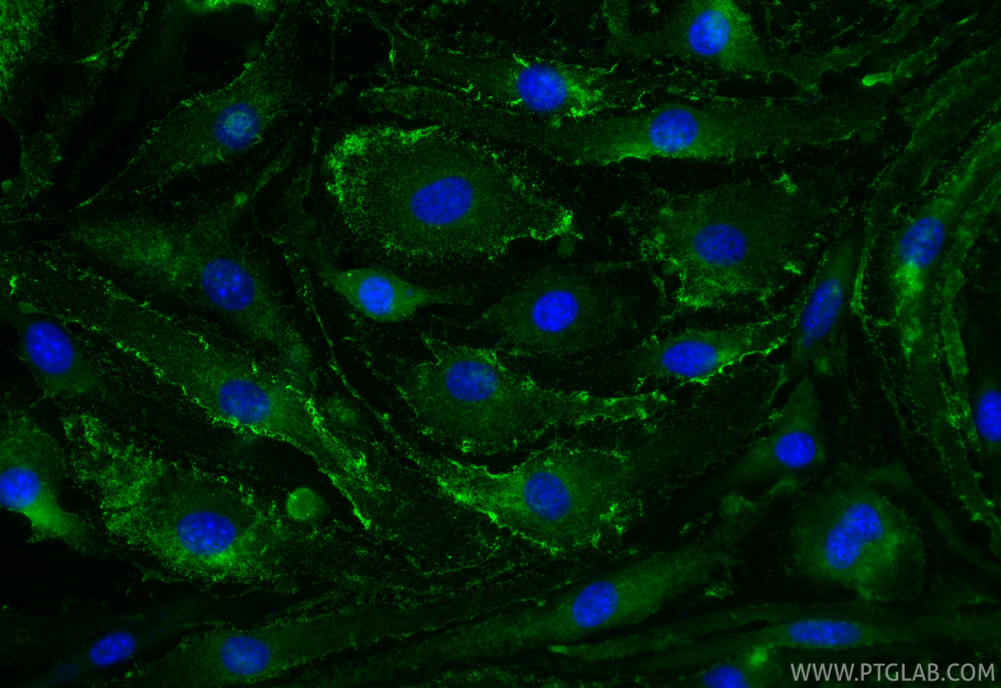 Immunofluorescence (IF) / fluorescent staining of bEnd.3 cells using Anti-Mouse PLVAP (MECA-32) (65214-1-Ig)