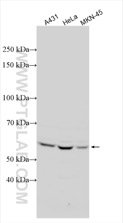 Western Blot (WB) analysis of various lysates using PLXDC2 Polyclonal antibody (12285-1-AP)