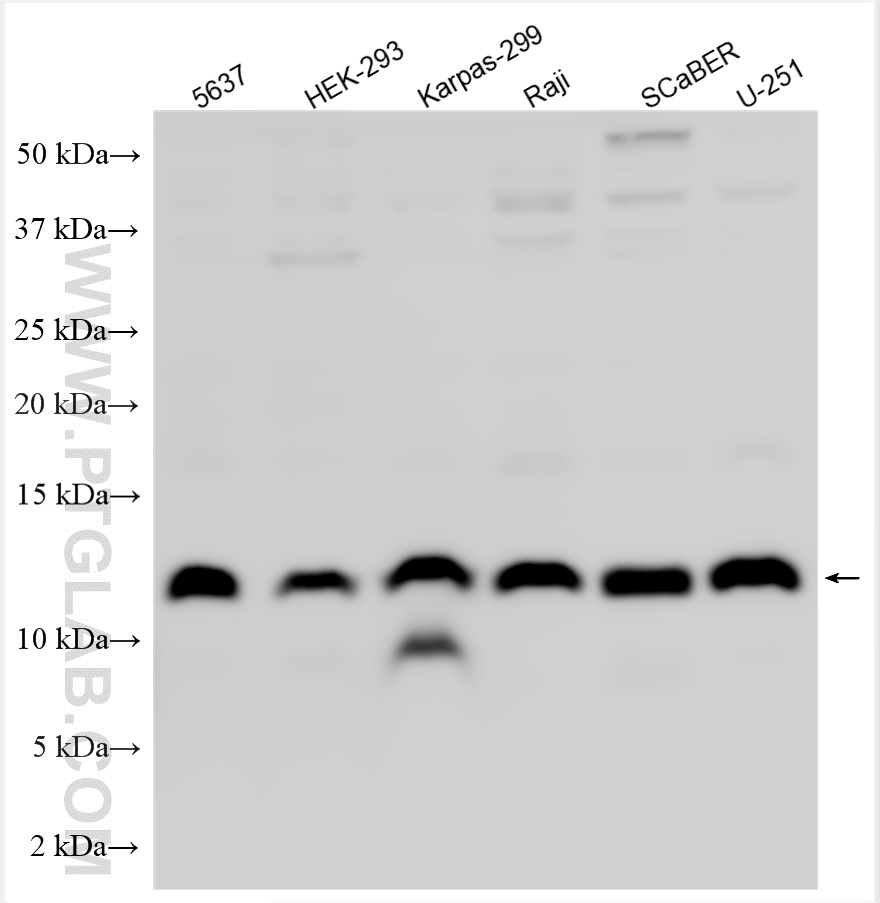 Western Blot (WB) analysis of various lysates using Noxa Polyclonal antibody (17418-1-AP)