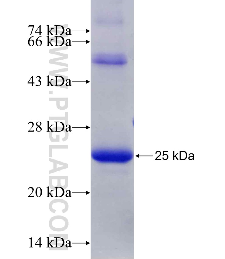 PMF1 fusion protein Ag29973 SDS-PAGE