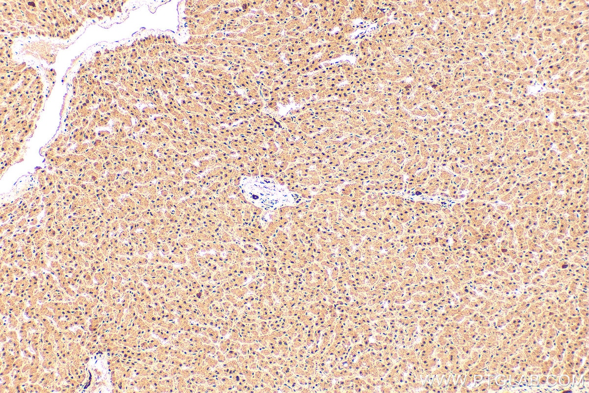 Immunohistochemistry (IHC) staining of human liver tissue using PML Polyclonal antibody (21041-1-AP)