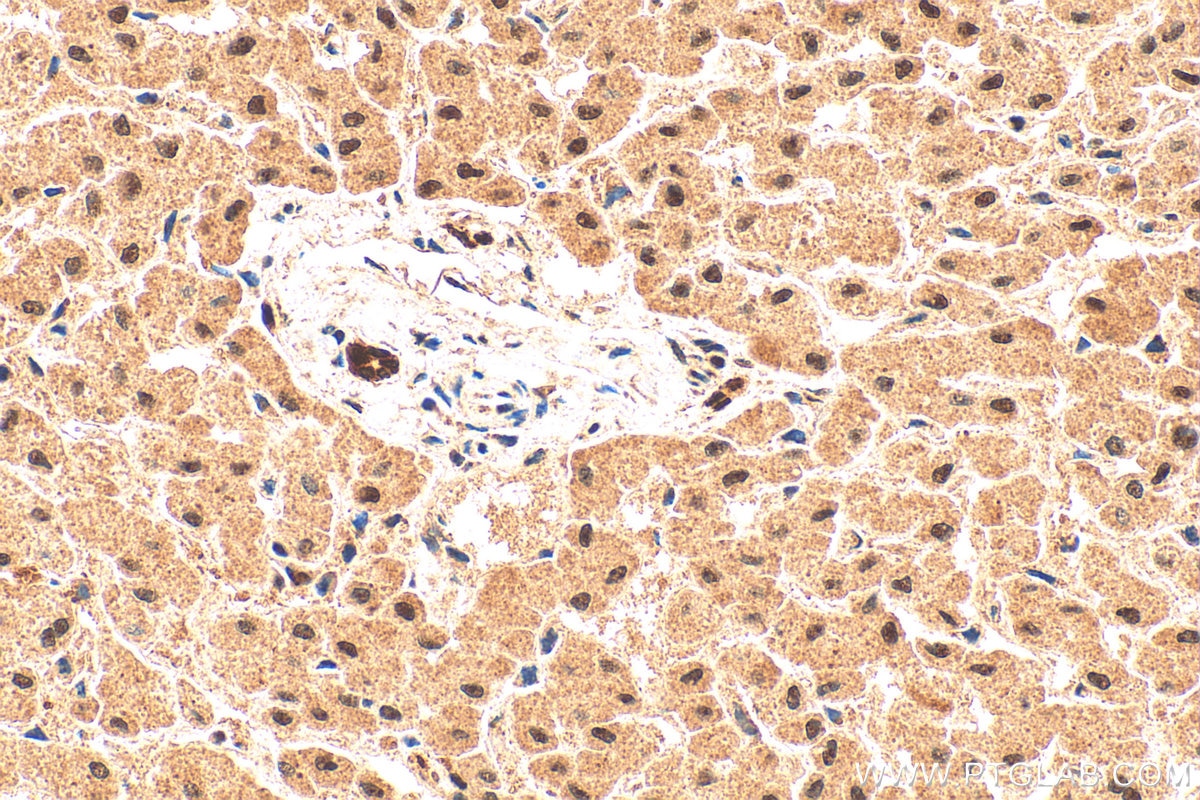 Immunohistochemistry (IHC) staining of human liver tissue using PML Polyclonal antibody (21041-1-AP)