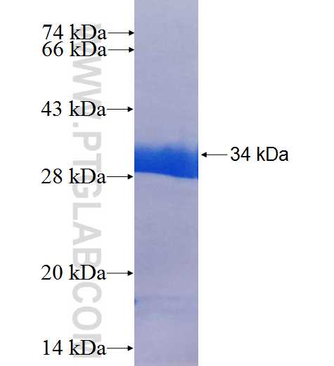 PMM2 fusion protein Ag25586 SDS-PAGE