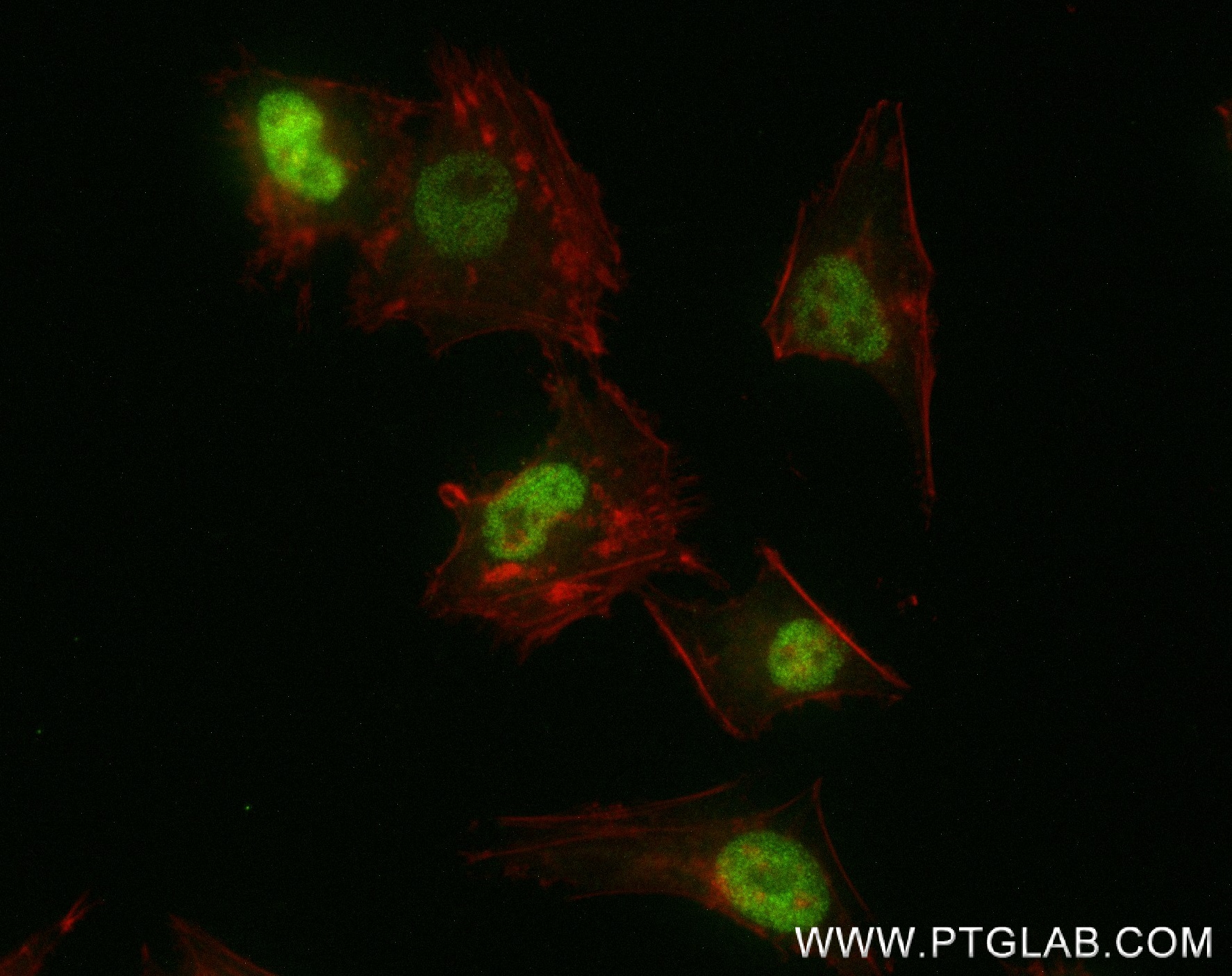 Immunofluorescence (IF) / fluorescent staining of HeLa cells using PMS1 Recombinant antibody (83456-6-RR)