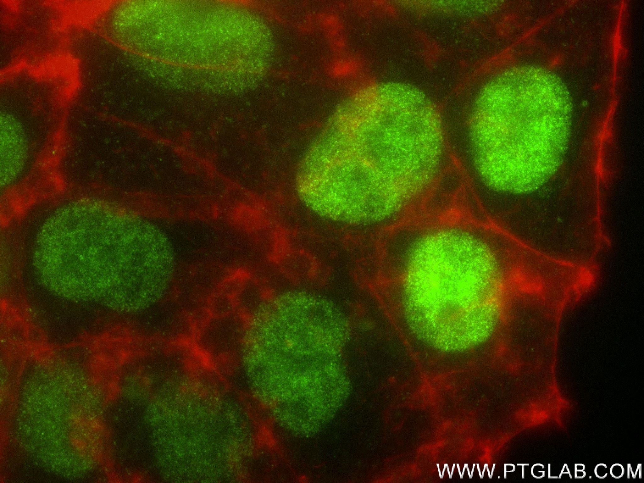 Immunofluorescence (IF) / fluorescent staining of Caco-2 cells using PMS1 Recombinant antibody (83456-6-RR)