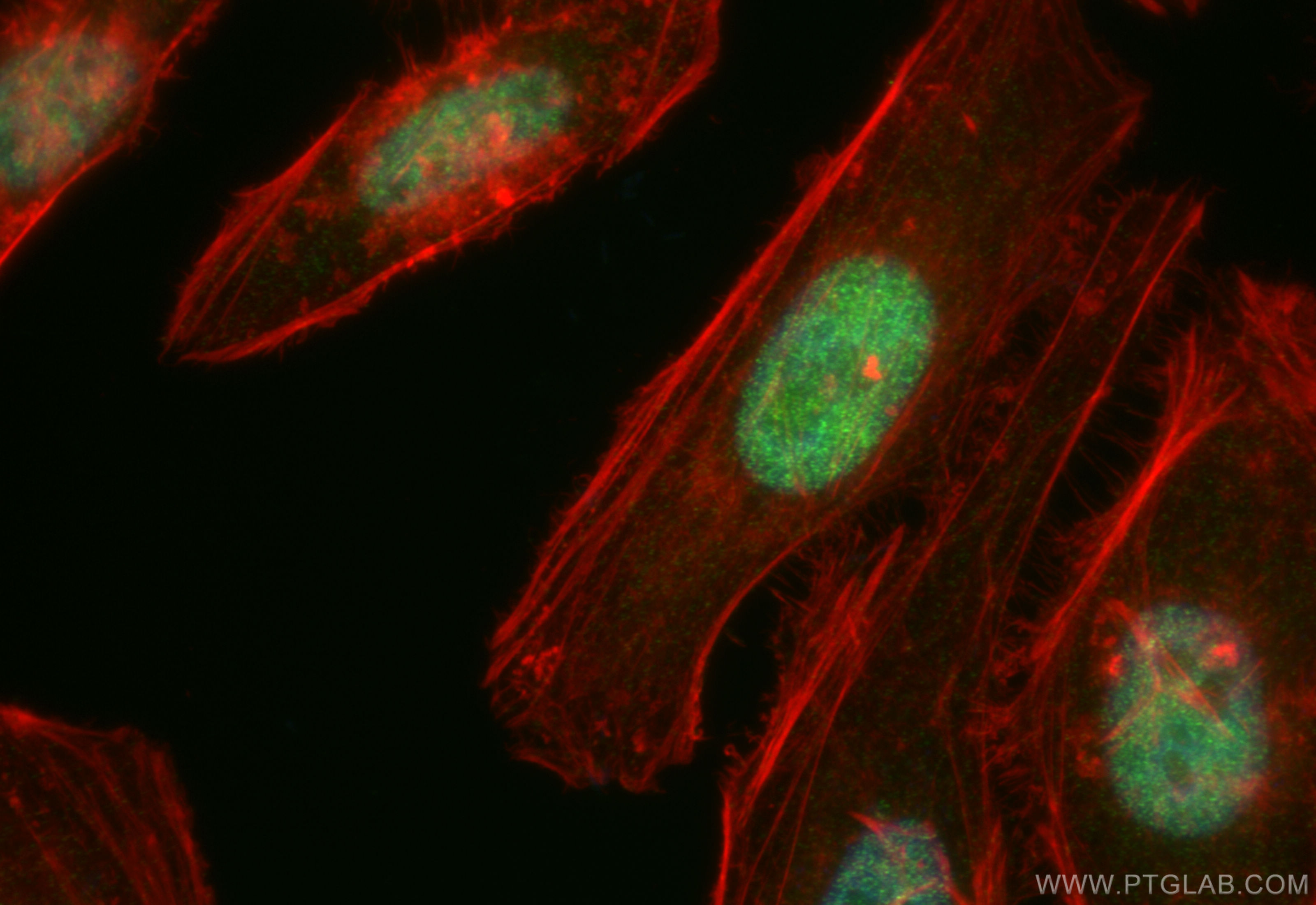 Immunofluorescence (IF) / fluorescent staining of HeLa cells using PMS1 Recombinant antibody (83456-6-RR)