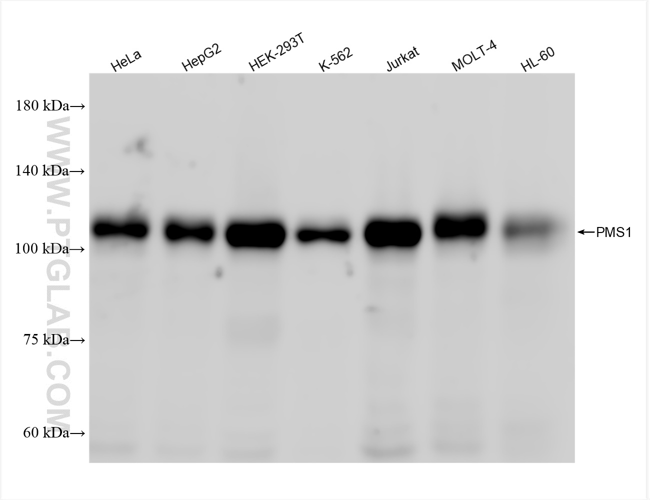 Western Blot (WB) analysis of various lysates using PMS1 Recombinant antibody (83456-6-RR)