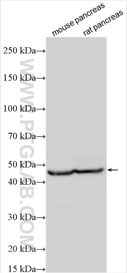 Western Blot (WB) analysis of various lysates using Pancreatic Lipase Polyclonal antibody (11209-1-AP)