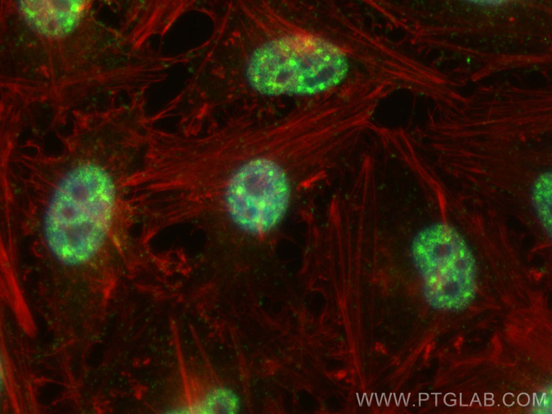 Immunofluorescence (IF) / fluorescent staining of HeLa cells using Pinin Polyclonal antibody (18266-1-AP)