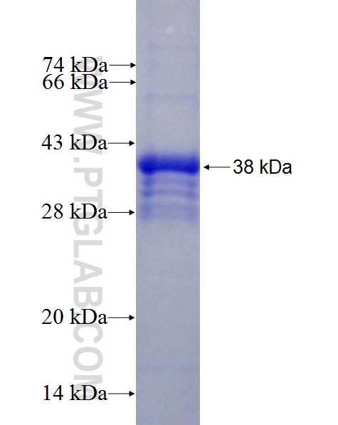 PNPLA3 fusion protein Ag27466 SDS-PAGE