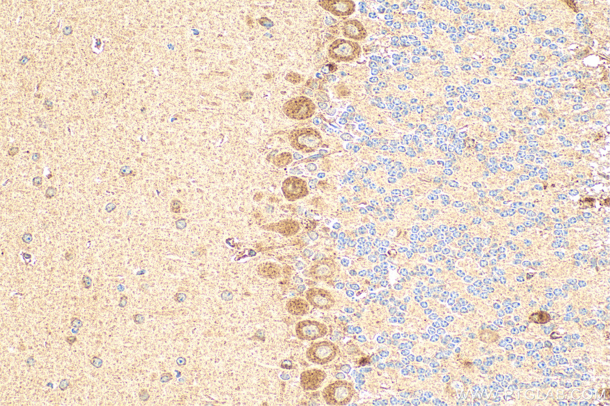 Immunohistochemistry (IHC) staining of mouse cerebellum tissue using PNPLA7 Polyclonal antibody (27787-1-AP)