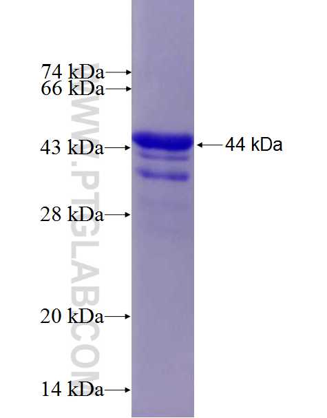 PNPLA7 fusion protein Ag27184 SDS-PAGE