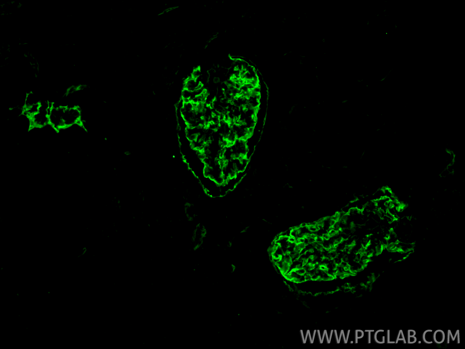 Immunofluorescence (IF) / fluorescent staining of human kidney tissue using Podocalyxin Polyclonal antibody (18150-1-AP)
