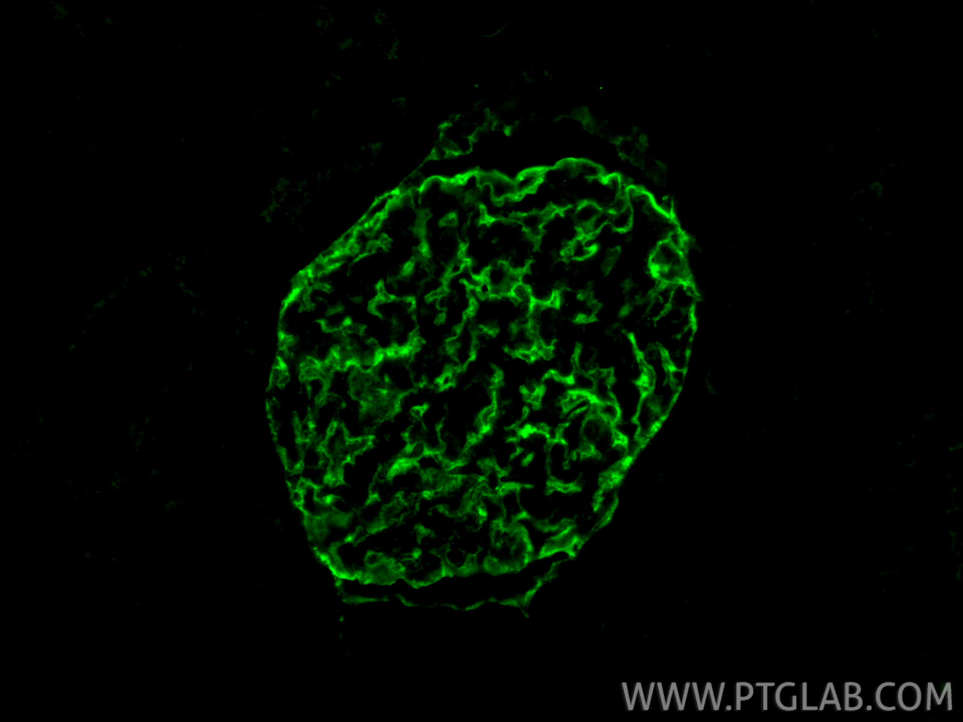 Immunofluorescence (IF) / fluorescent staining of human kidney tissue using Podocalyxin Polyclonal antibody (18150-1-AP)