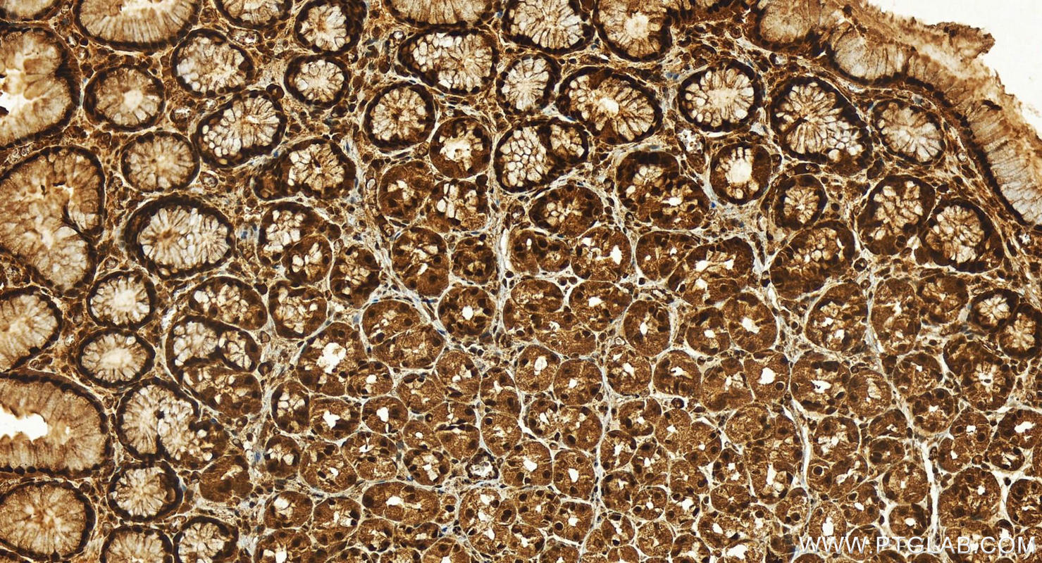 Immunohistochemistry (IHC) staining of human stomach tissue using SKAR Polyclonal antibody (17466-1-AP)