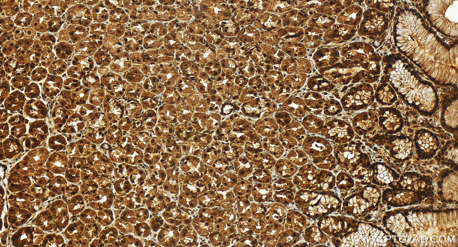 Immunohistochemistry (IHC) staining of human stomach tissue using SKAR Polyclonal antibody (17466-1-AP)