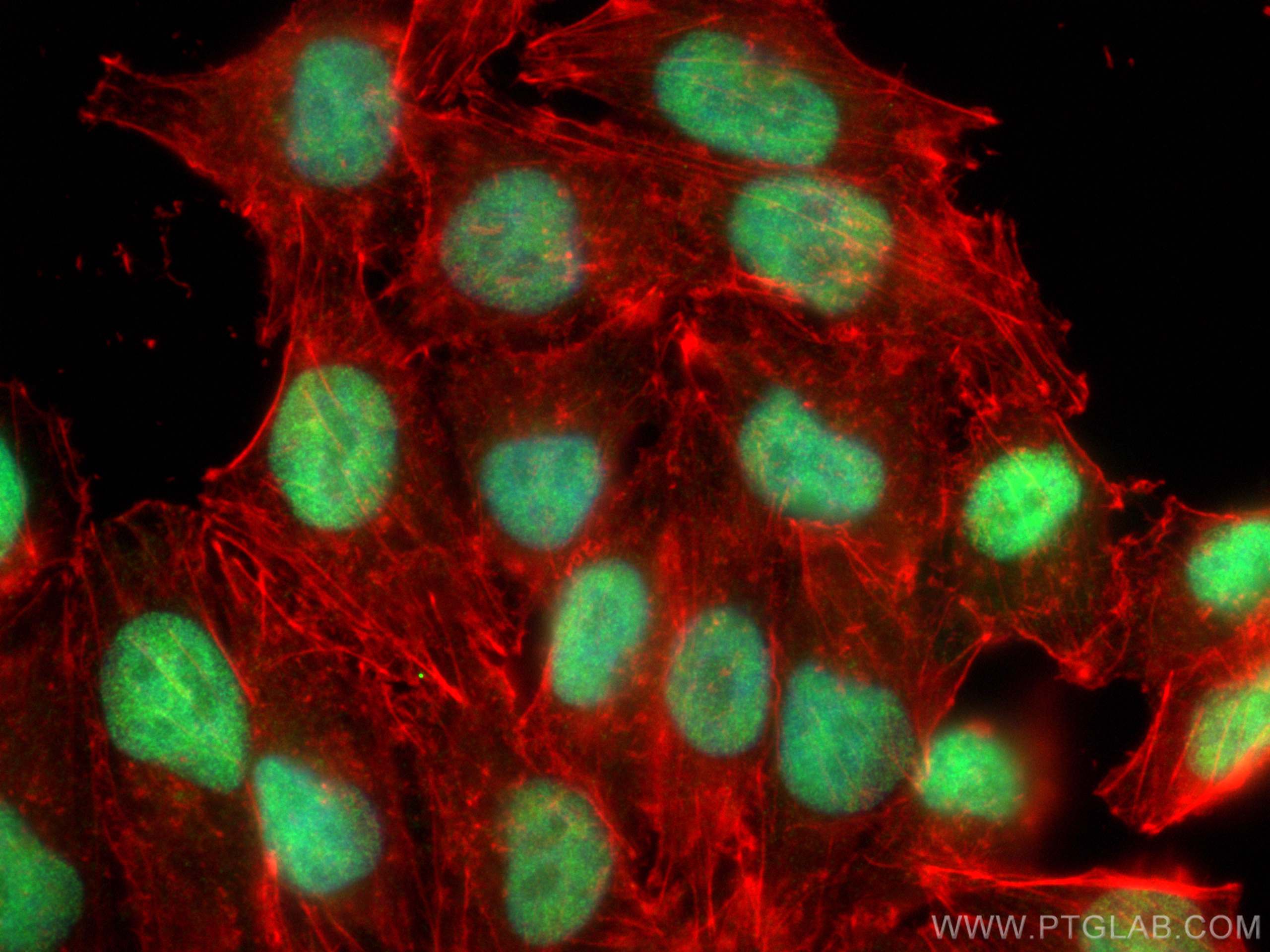 Immunofluorescence (IF) / fluorescent staining of A375 cells using POLQ Polyclonal antibody (28590-1-AP)