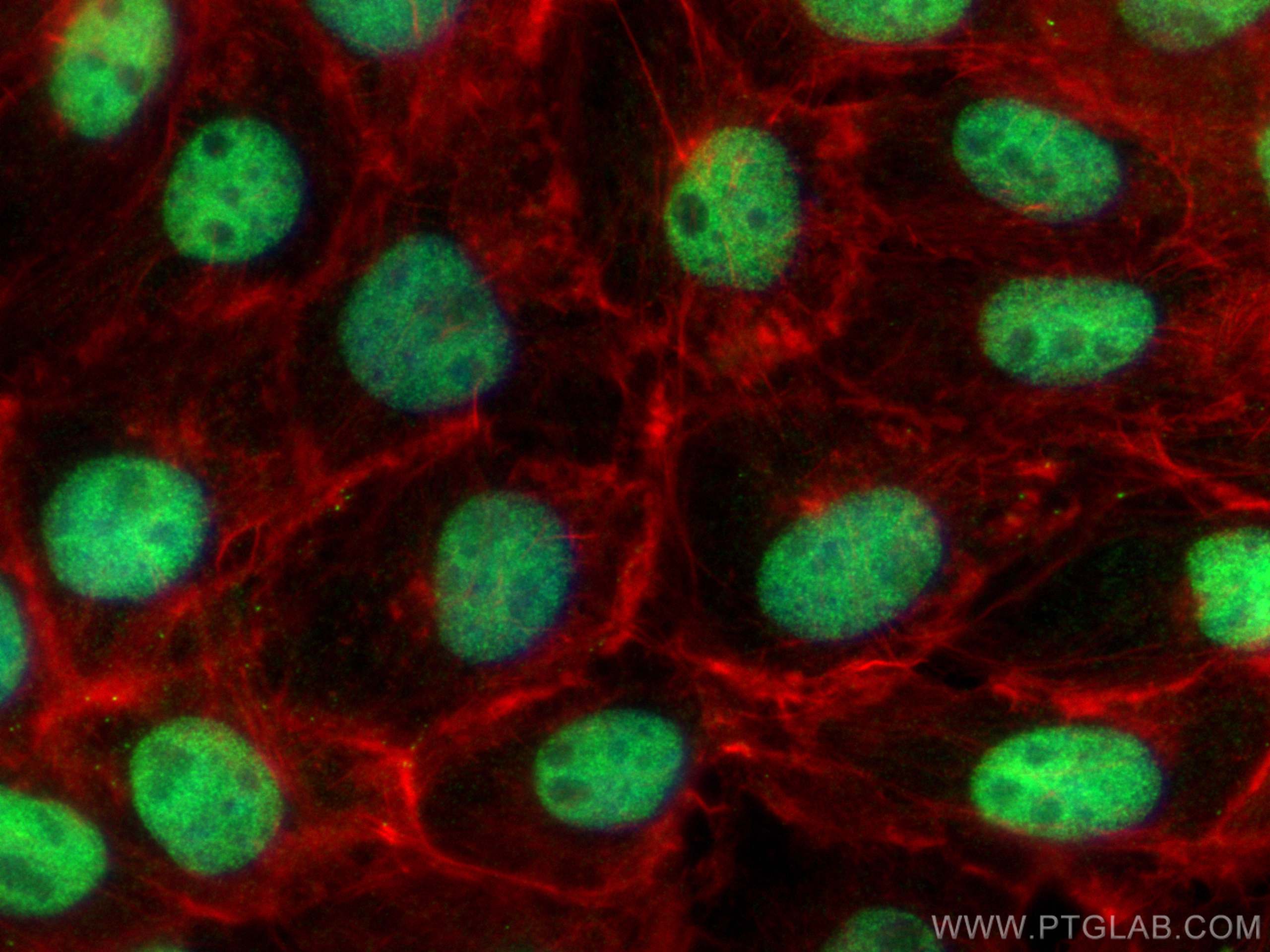 Immunofluorescence (IF) / fluorescent staining of A431 cells using POLQ Polyclonal antibody (28590-1-AP)