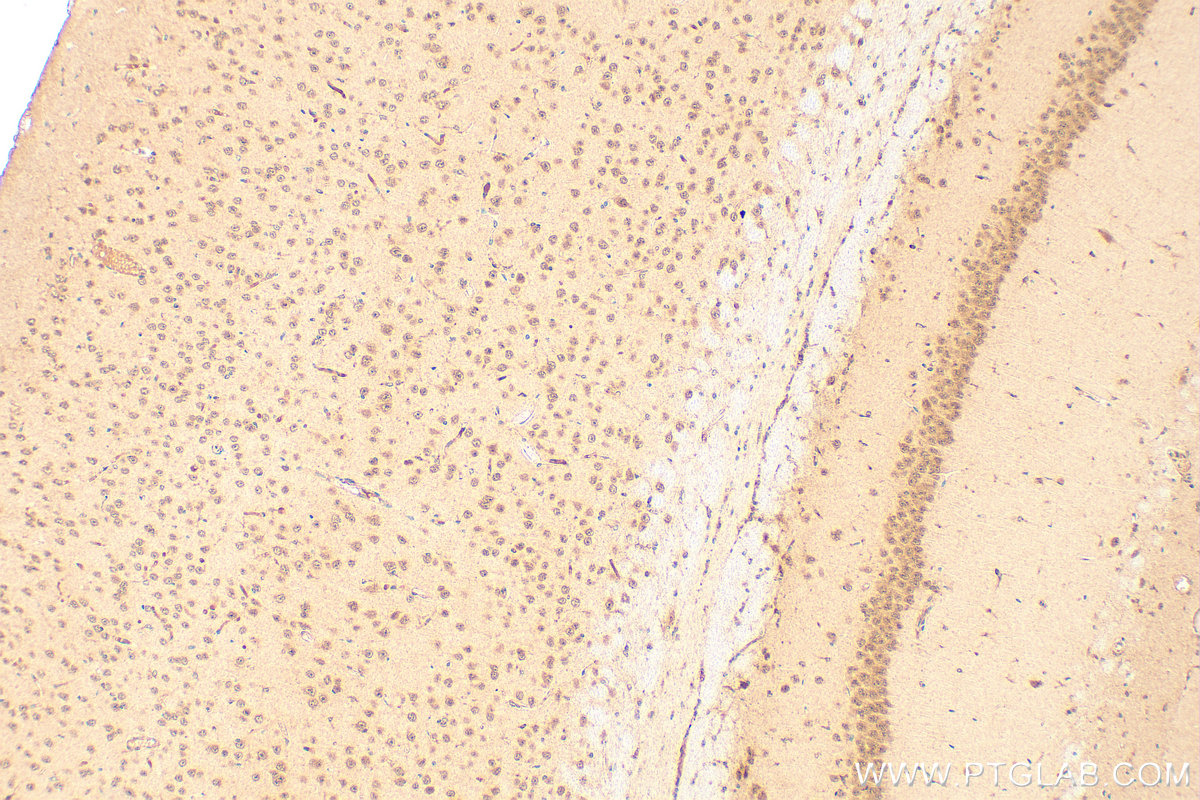 Immunohistochemistry (IHC) staining of mouse brain tissue using POLR2I Polyclonal antibody (17270-1-AP)