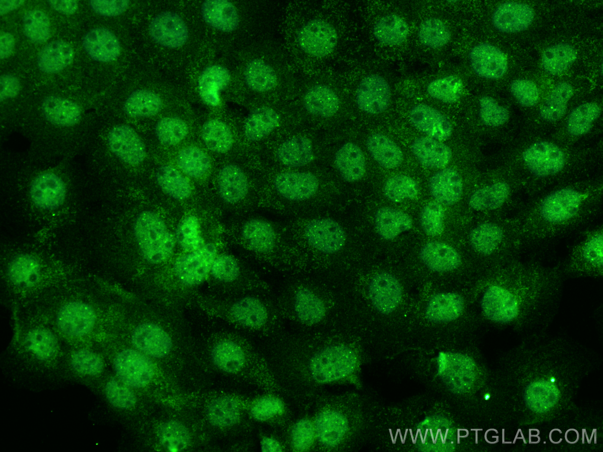 Immunofluorescence (IF) / fluorescent staining of A431 cells using POLR3A Polyclonal antibody (28842-1-AP)