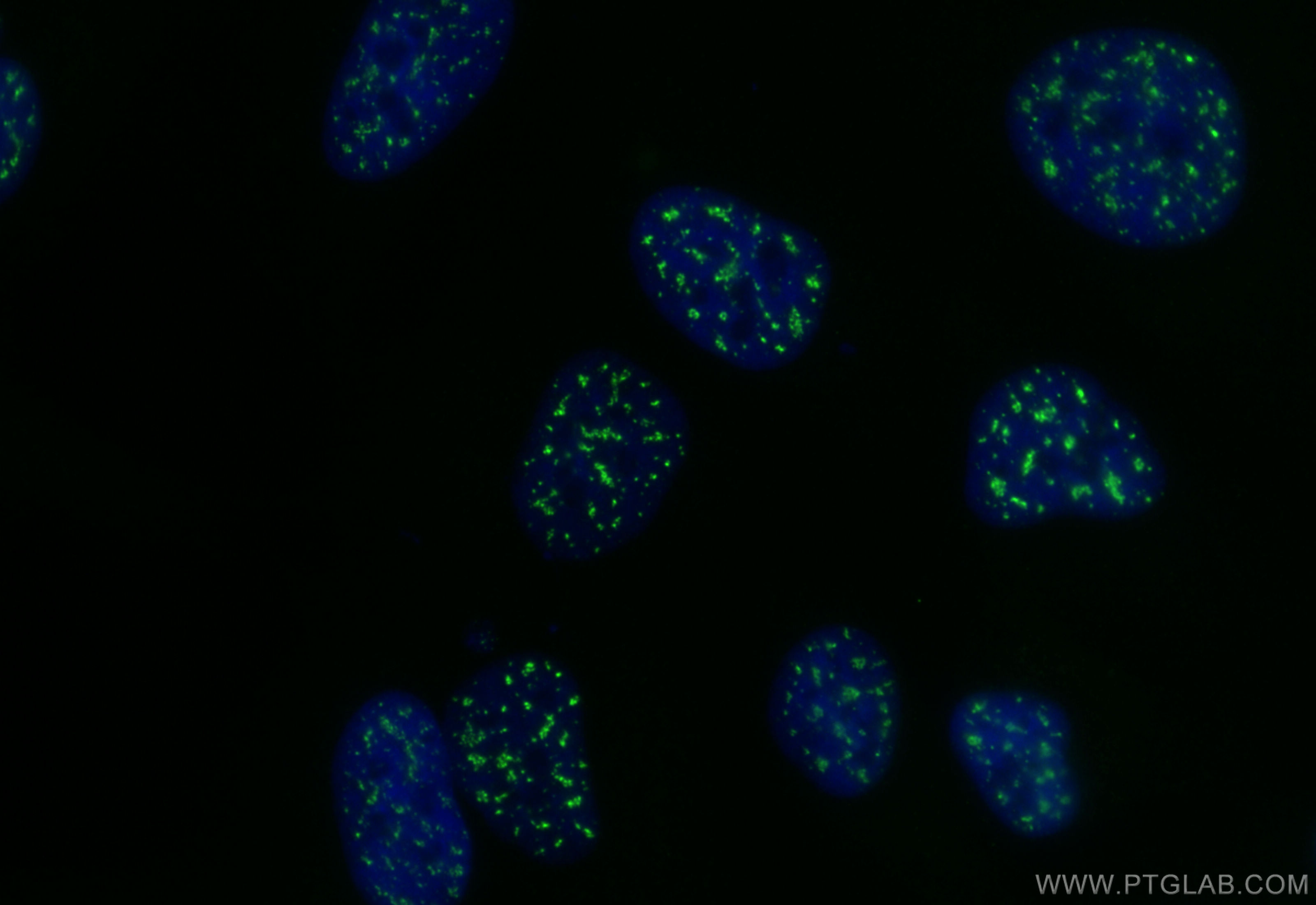 Immunofluorescence (IF) / fluorescent staining of Hela cells using CoraLite® Plus 488-conjugated POLR3C Recombinant a (CL488-84367-7)