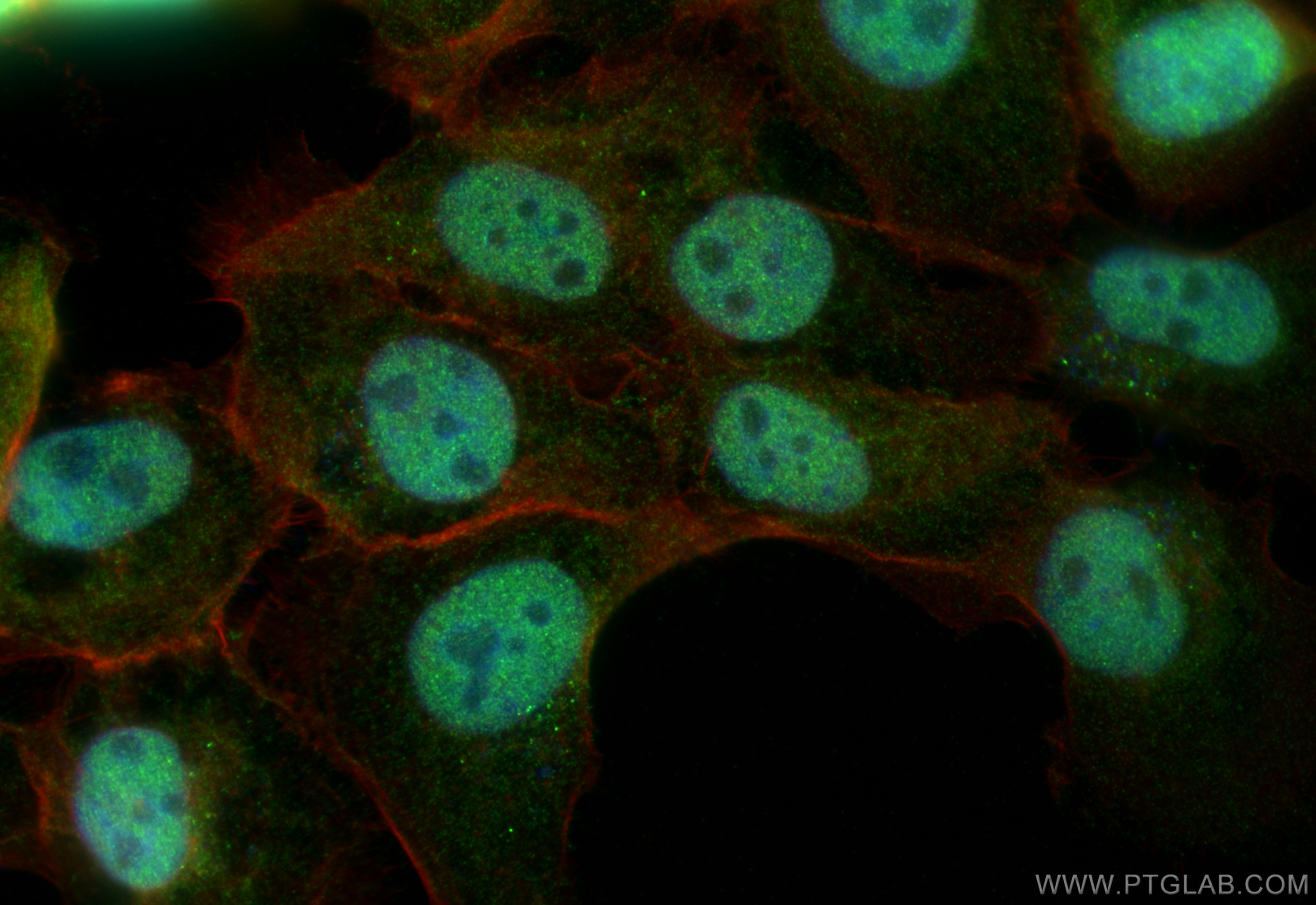 Immunofluorescence (IF) / fluorescent staining of A431 cells using POLR3H Polyclonal antibody (16423-1-AP)