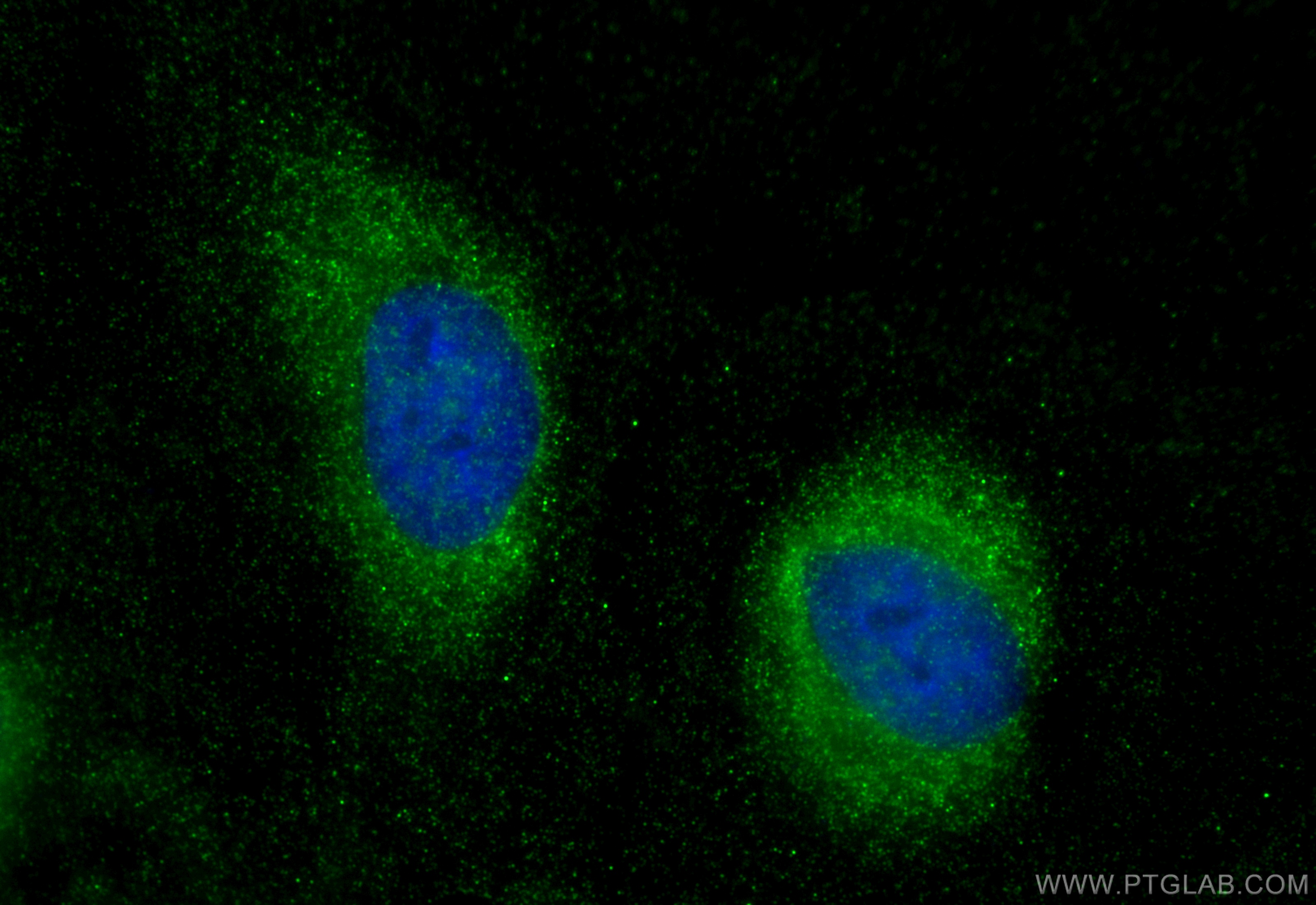 Immunofluorescence (IF) / fluorescent staining of HeLa cells using POMC Polyclonal antibody (22102-1-AP)