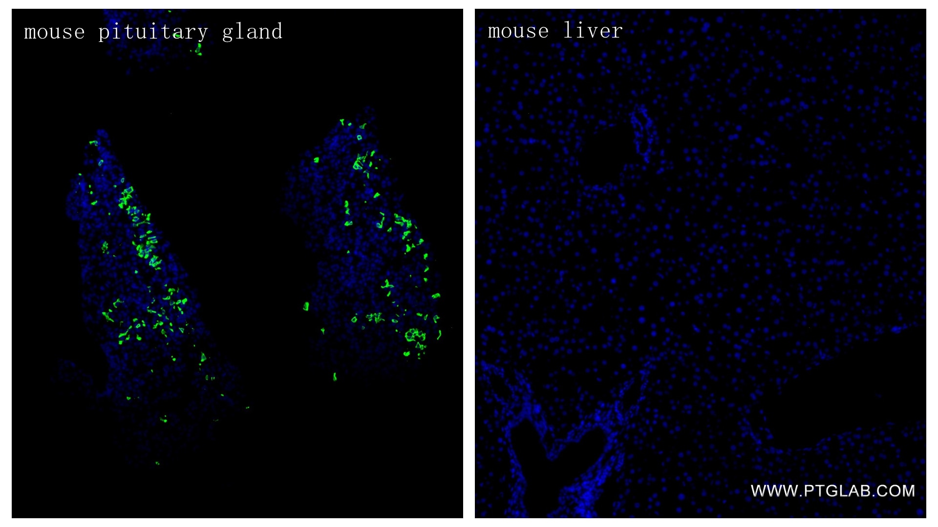 Immunofluorescence (IF) / fluorescent staining of mouse pituitary gland tissue using ACTH Recombinant monoclonal antibody (82498-2-RR)