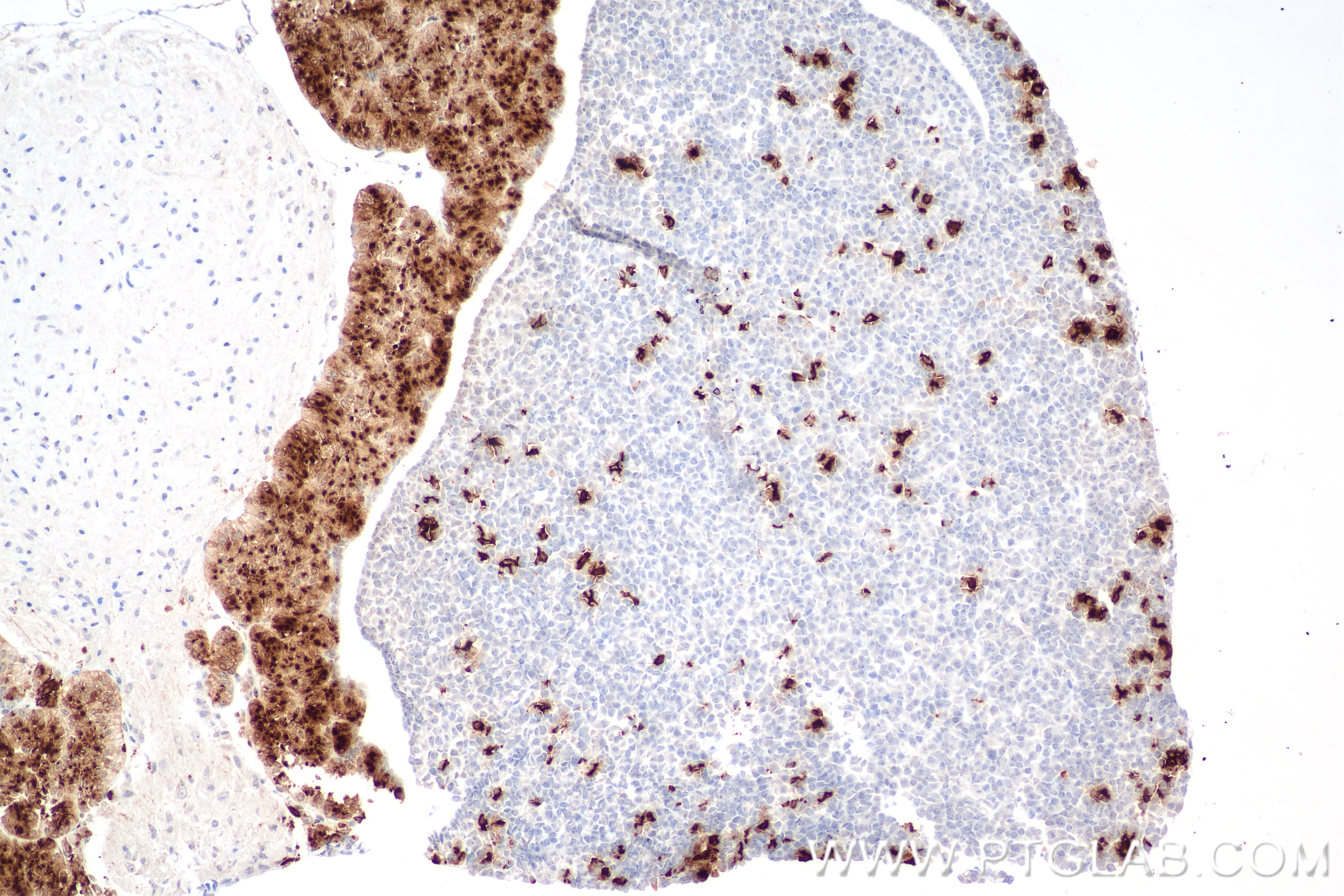 Immunohistochemistry (IHC) staining of mouse pituitary gland tissue using ACTH Recombinant monoclonal antibody (82498-2-RR)