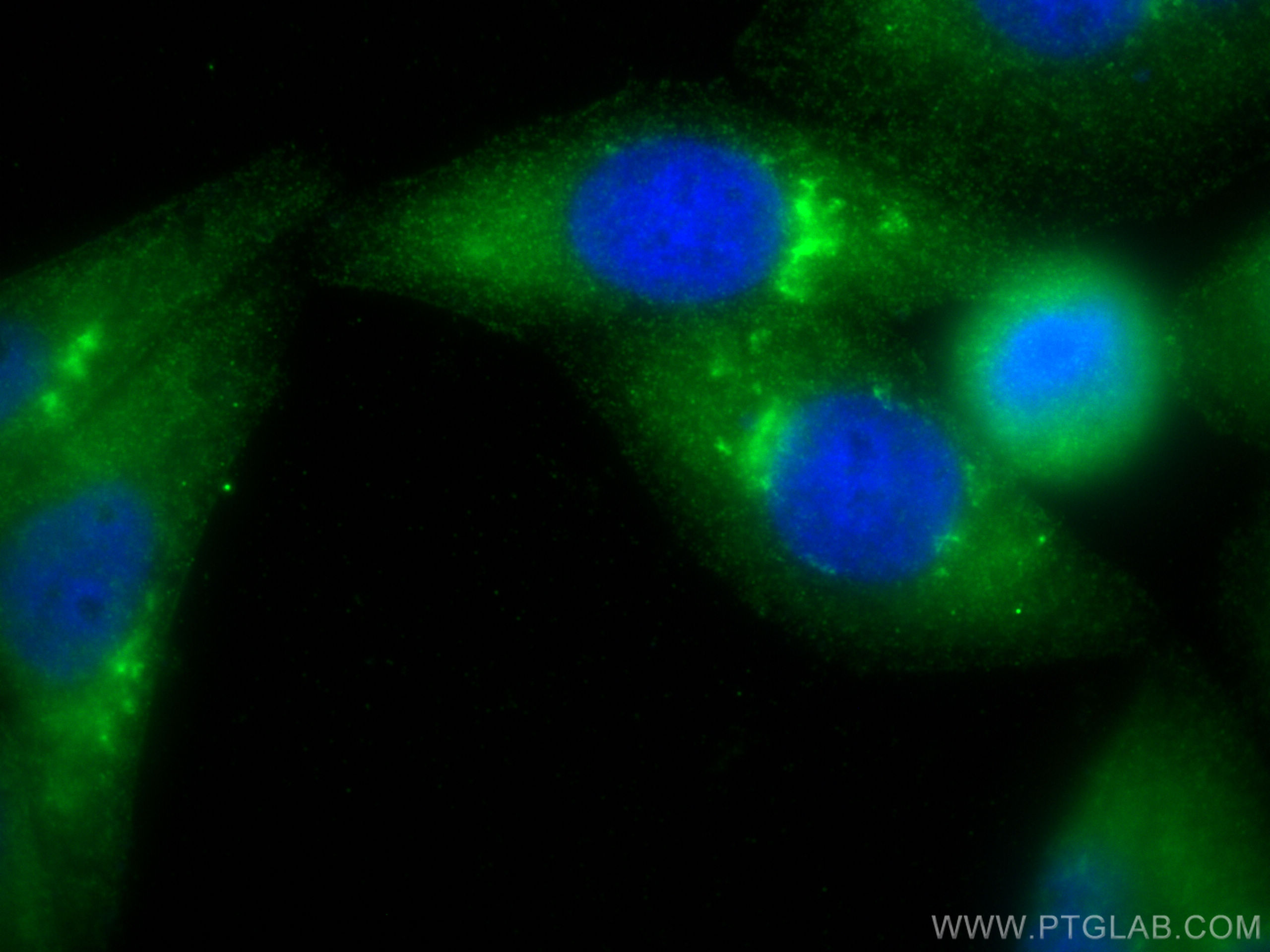 Immunofluorescence (IF) / fluorescent staining of HepG2 cells using POMP Polyclonal antibody (15046-1-AP)