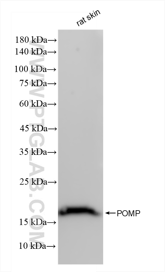 Western Blot (WB) analysis of rat skin tissue using POMP Recombinant antibody (83607-6-RR)