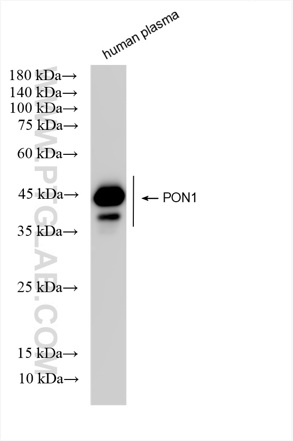 Western Blot (WB) analysis of various lysates using PON1 Recombinant antibody (83982-2-RR)