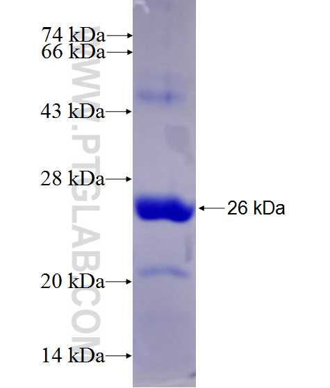 POSTN fusion protein Ag27200 SDS-PAGE