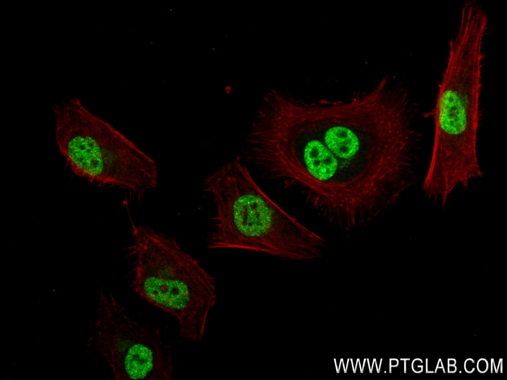 Immunofluorescence (IF) / fluorescent staining of HeLa cells using POT1 Recombinant antibody (83732-2-RR)