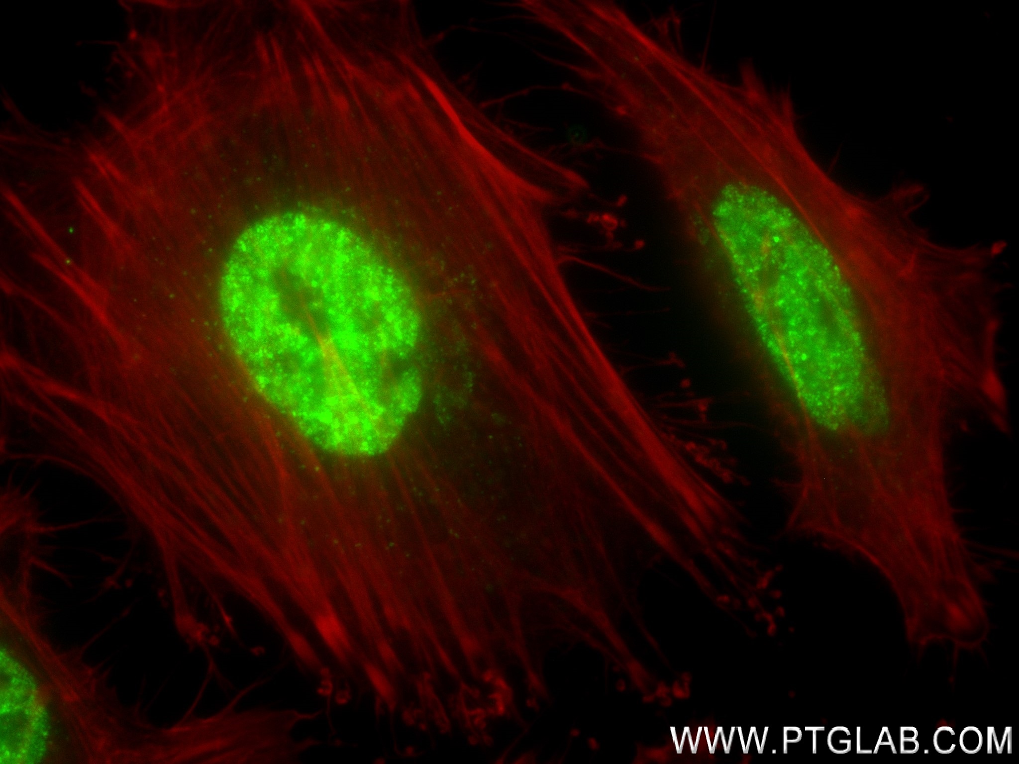 Immunofluorescence (IF) / fluorescent staining of HeLa cells using POT1 Recombinant antibody (83732-2-RR)