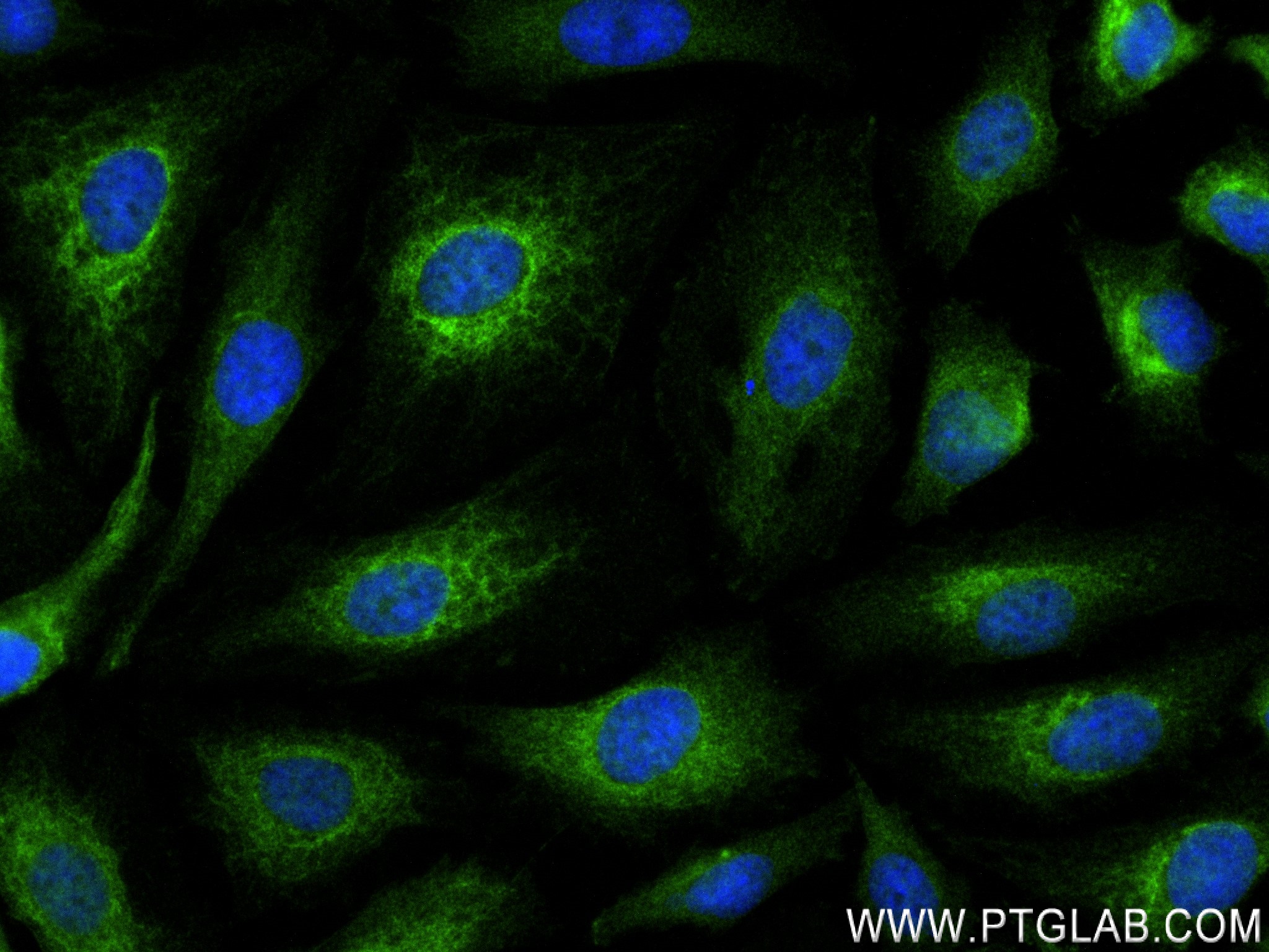 Immunofluorescence (IF) / fluorescent staining of HepG2 cells using POTEA-Specific Recombinant antibody (84298-1-RR)