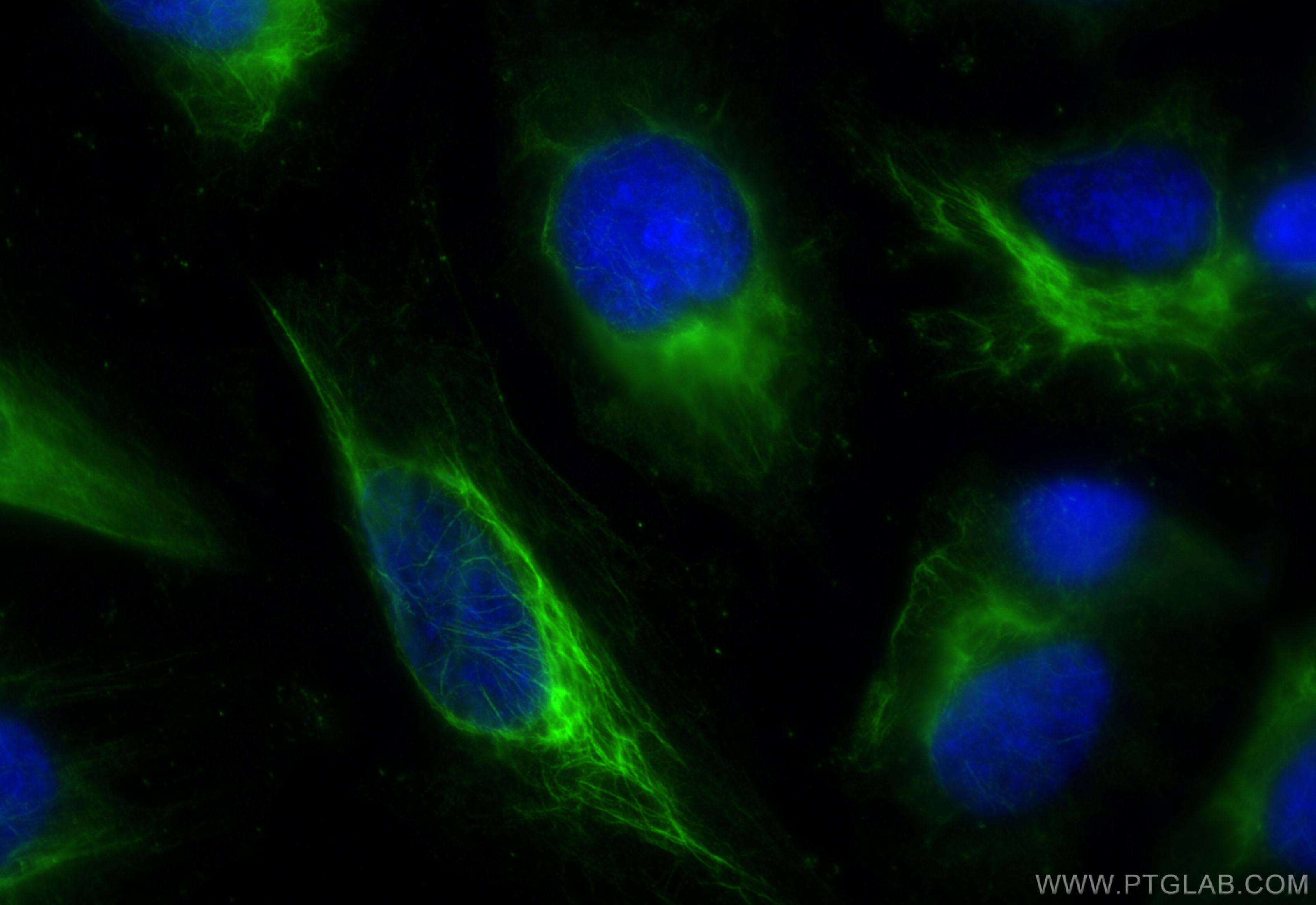 Immunofluorescence (IF) / fluorescent staining of HeLa cells using POTEA-Specific Recombinant antibody (84298-1-RR)