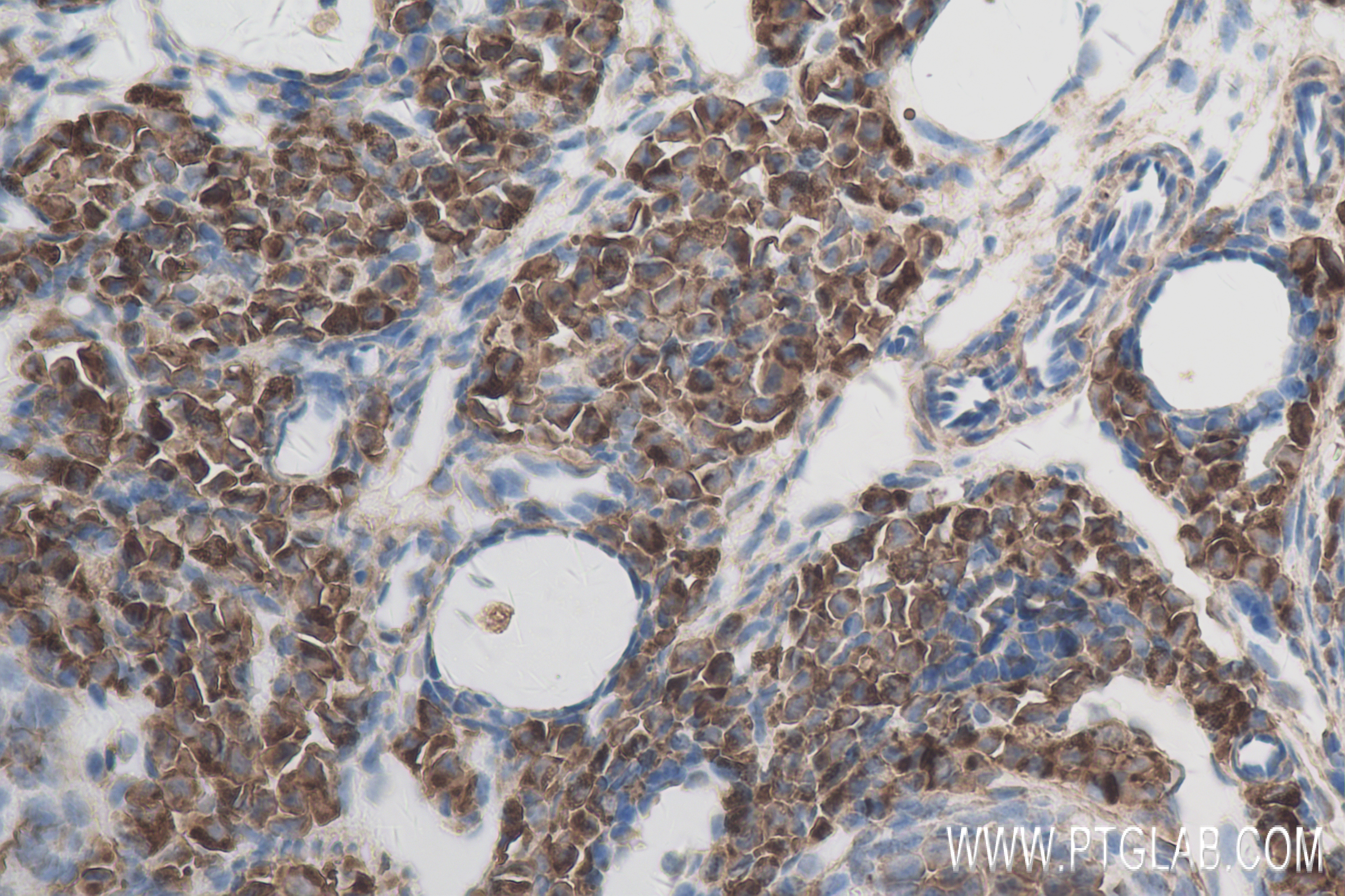 Immunohistochemistry (IHC) staining of mouse ovary tissue using POTEA-Specific Recombinant antibody (84298-1-RR)