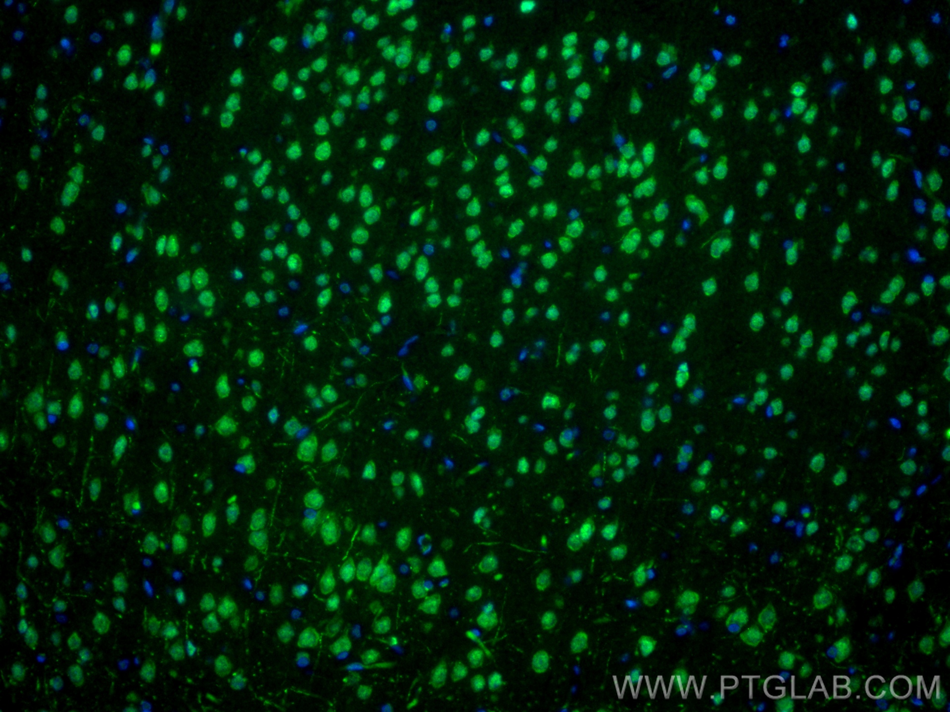 Immunofluorescence (IF) / fluorescent staining of rat brain tissue using POU4F3 Recombinant antibody (82980-1-RR)