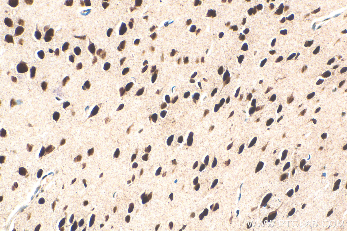 Immunohistochemistry (IHC) staining of mouse brain tissue using POU4F3 Recombinant antibody (82980-1-RR)