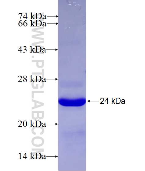 POU6F1 fusion protein Ag27364 SDS-PAGE