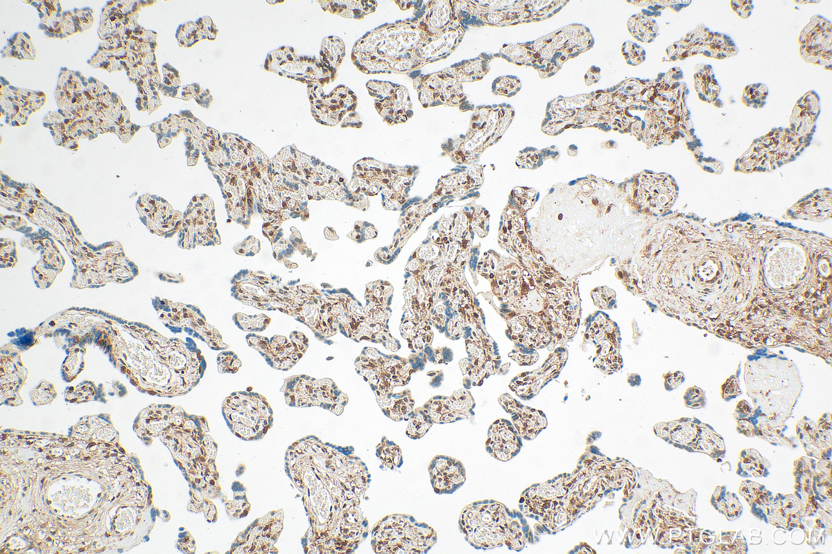 Immunohistochemistry (IHC) staining of human placenta tissue using PPAR Gamma Recombinant antibody (81490-5-RR)