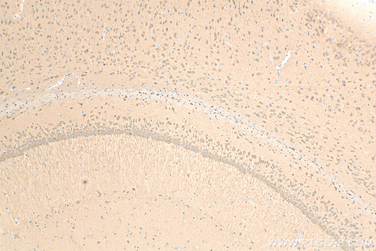 Immunohistochemistry (IHC) staining of mouse brain tissue using PPAR Gamma Recombinant antibody (81490-5-RR)